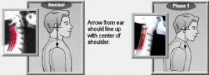 Posture-and-Your-Health_img_2