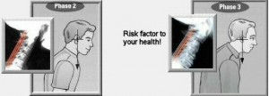 Posture-and-Your-Health_img_3